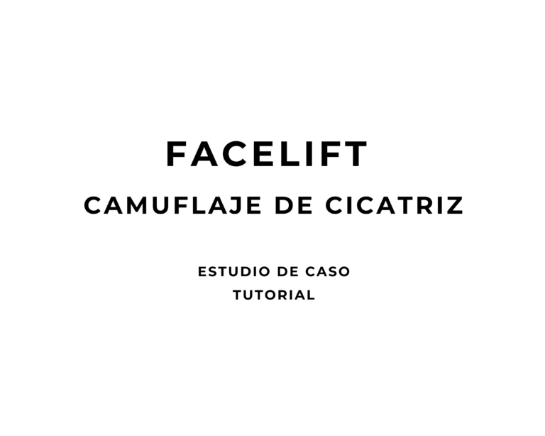 FACELIFT | CAMUFLAJE DE CICATRIZ