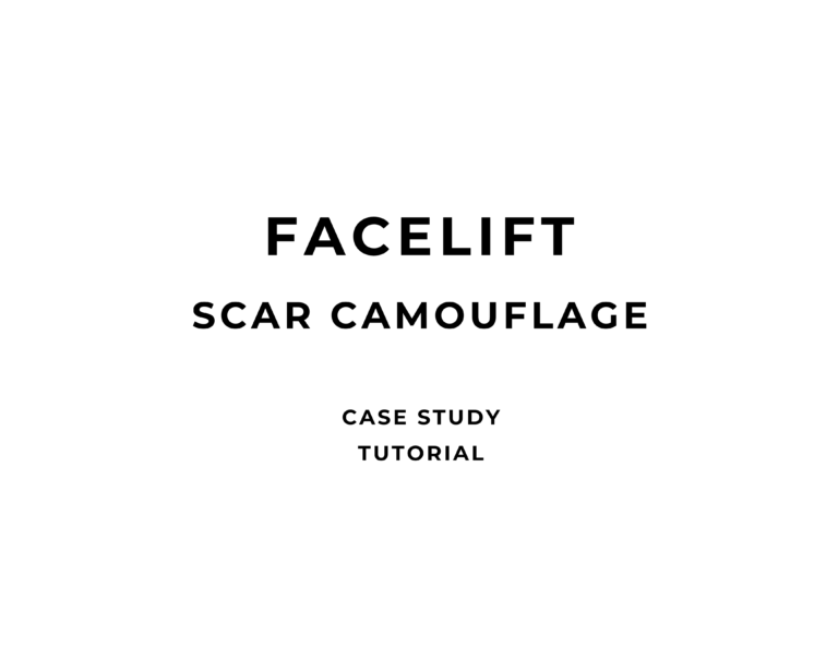 FACELIFT SCAR CAMOUFLAGE